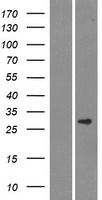 C12orf69 (SMCO3) Human Over-expression Lysates NM_001013698