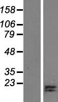 CCDC196 Human Over-expression Lysates NM_001004331