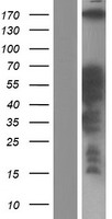 CCDC88C Human Over-expression Lysates NM_001080414