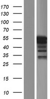 LSDP5 (PLIN5) Human Over-expression Lysates NM_001013706
