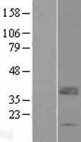 LRRC52 Human Over-expression Lysates NM_001005214