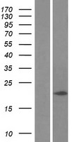 LC3C (MAP1LC3C) Human Over-expression Lysates NM_001004343