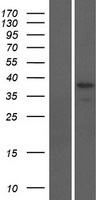 ls440836 odf3b human over expression lysates nm 001014440 wb testing 1