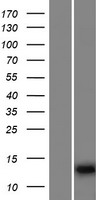 IQCF6 Human Over-expression Lysates NM_001143833