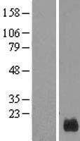 GUSBP5 Human Over-expression Lysates NM_001011539