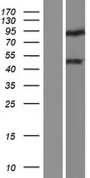DUX4L4 Human Over-expression Lysates NM_001177376