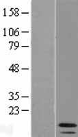 IRF1-AS1 Human Over-expression Lysates NM_001013717