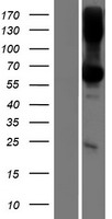 TMEM151B Human Over-expression Lysates NM_001137560