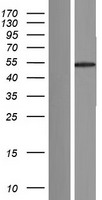 FAM90A18P Human Over-expression Lysates NM_001164451