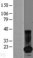 ls441525 spanxn4 human over expression lysates nm 001009613 wb testing 1