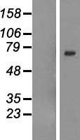 GALNTL6 Human Over-expression Lysates NM_001034845