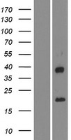 IGFL4 Human Over-expression Lysates NM_001002923