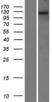 POTEE Human Over-expression Lysates NM_001083538