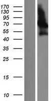 PALM2 Human Over-expression Lysates NM_053016