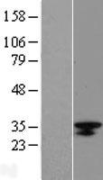 ls474354 lrrc18 human over expression lysates nm 001006939 wb testing 1