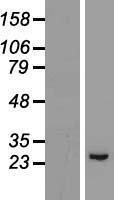 ls493869 gpx8 human over expression lysates nm 001008397 wb testing 1