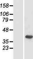 ls494513 pejvakin dfnb59 human over expression lysates nm 001042702 wb testing 1