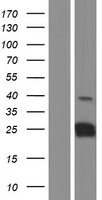 CT45A1 Human Over-expression Lysates NM_001017417
