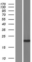 SLX1 (SLX1A) Human Over-expression Lysates NM_001015000