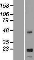 ls554235 aspdh human over expression lysates nm 001024656 wb testing 2