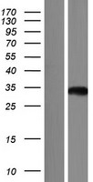 ls554235 aspdh human over expression lysates nm 001114598 wb testing 1