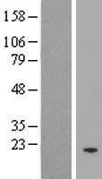 ls554251 fbxo48 human over expression lysates nm 001024680 wb testing 1