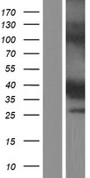ls606495 cyb5rl human over expression lysates nm 001031672 wb testing 1