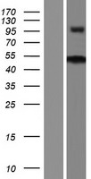 ZNF704 Human Over-expression Lysates NM_001033723