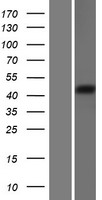 Ghrelin O acyltransferase (MBOAT4) Human Over-expression Lysates NM_001100916