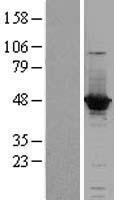 ACOT1 Human Over-expression Lysates NM_001037161