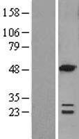 ls641372 acot6 human over expression lysates nm 001037162 wb testing 1