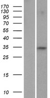 ls642273 fam110c human over expression lysates nm 001077710 wb testing 1