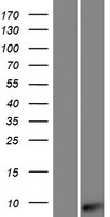 AKAIN1 Human Over-expression Lysates NM_001145194