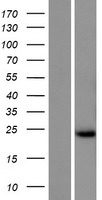 TMEM253 Human Over-expression Lysates NM_001146683