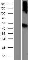 ls643418 lipn human over expression lysates nm 001102469 wb testing 1