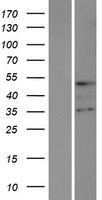 TMPPE Human Over-expression Lysates NM_001039770