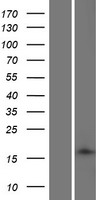 ls643965 transmembrane protein 88b tmem88b human over expression lysates nm 001146685 wb testing 1