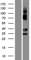 EVPLL Human Over-expression Lysates NM_001145127