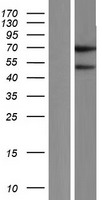 FAM90A14P Human Over-expression Lysates NM_001164452