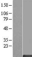 MT1HL1 Human Over-expression Lysates NM_001039954