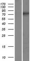 ls645811 ccdc154 human over expression lysates nm 001143980 wb testing 1