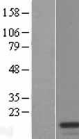 TXNRD3IT1 (TXNRD3NB) Human Over-expression Lysates NM_001039783