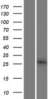 CBY3 Human Over-expression Lysates NM_001164444
