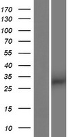 ARIH2OS Human Over-expression Lysates NM_001123040
