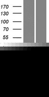 FABP12 Human Over-expression Lysates NM_001105281