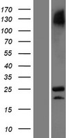 C3orf84 Human Over-expression Lysates NM_001080528