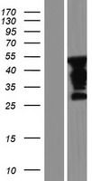 FAM90A27P Human Over-expression Lysates NM_001195187