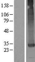 ls652968 castor1 human over expression lysates nm 001037666 wb testing 1
