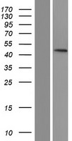 PTPN20A Human Over-expression Lysates NM_001042395
