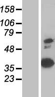 Annexin VIII (ANXA8) Human Over-expression Lysates NM_001040084